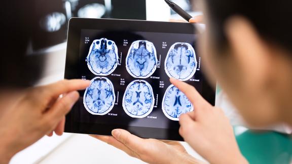 Two doctors analysing brain scans on a tablet.